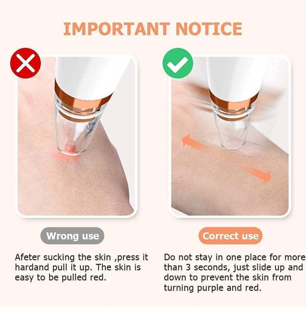 Multifunctional Blackhead Remover