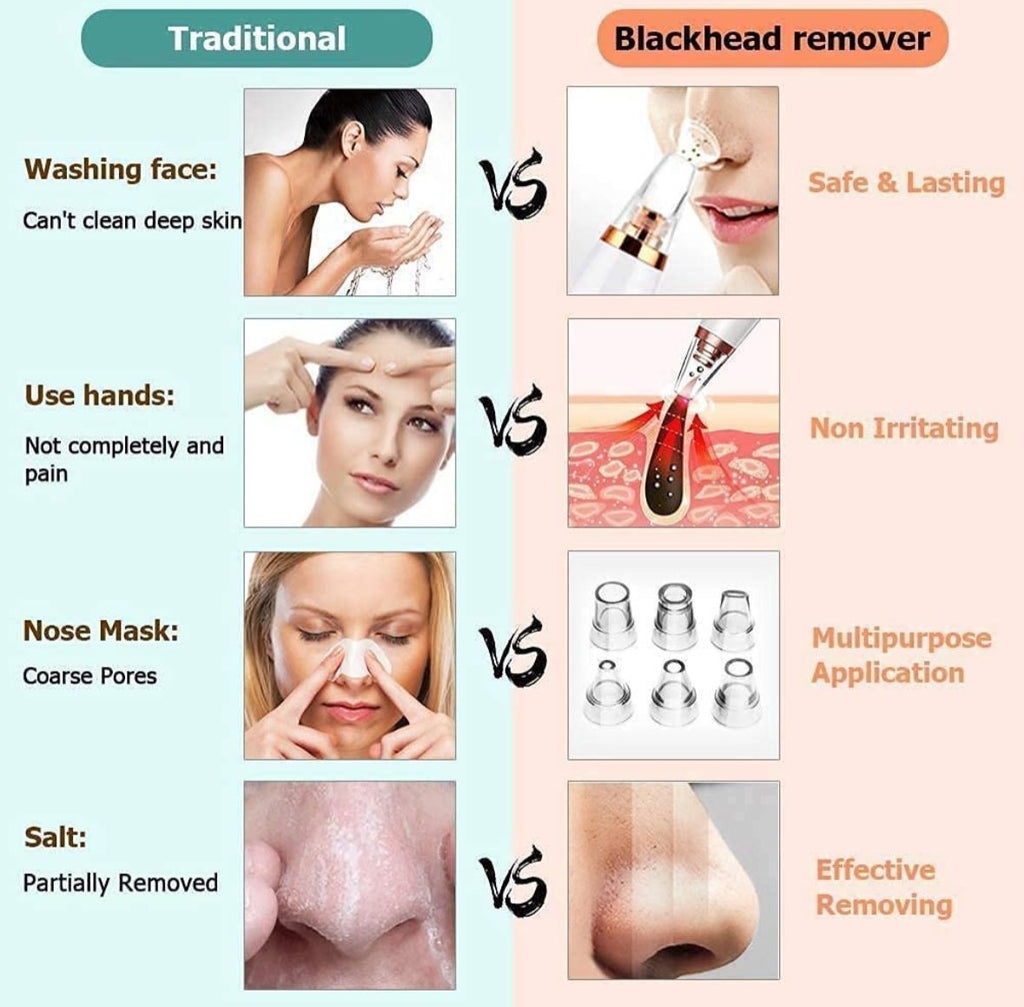 Multifunctional Blackhead Remover